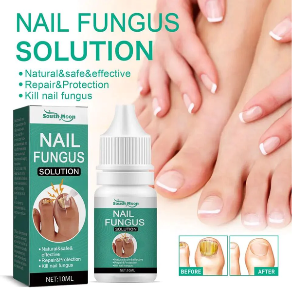 Nail fungus solution
